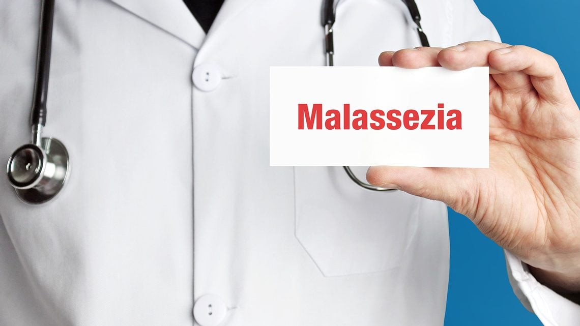Malassezia-Hefepilz bekämpfen